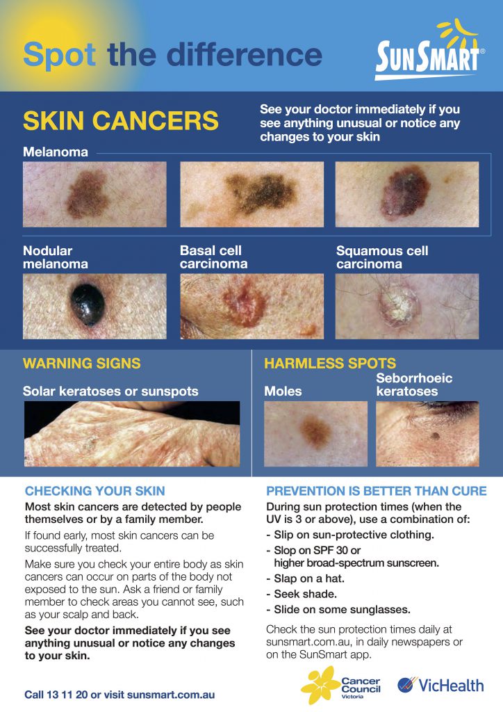 Skin Checks & Mole Removal - Cranbourne & Croydon | HealthMint