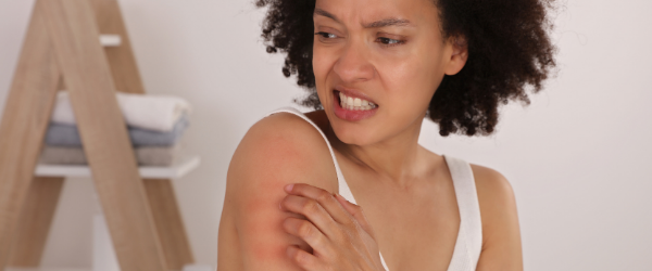 symptoms of food allergies - healthmint lady scratching arm